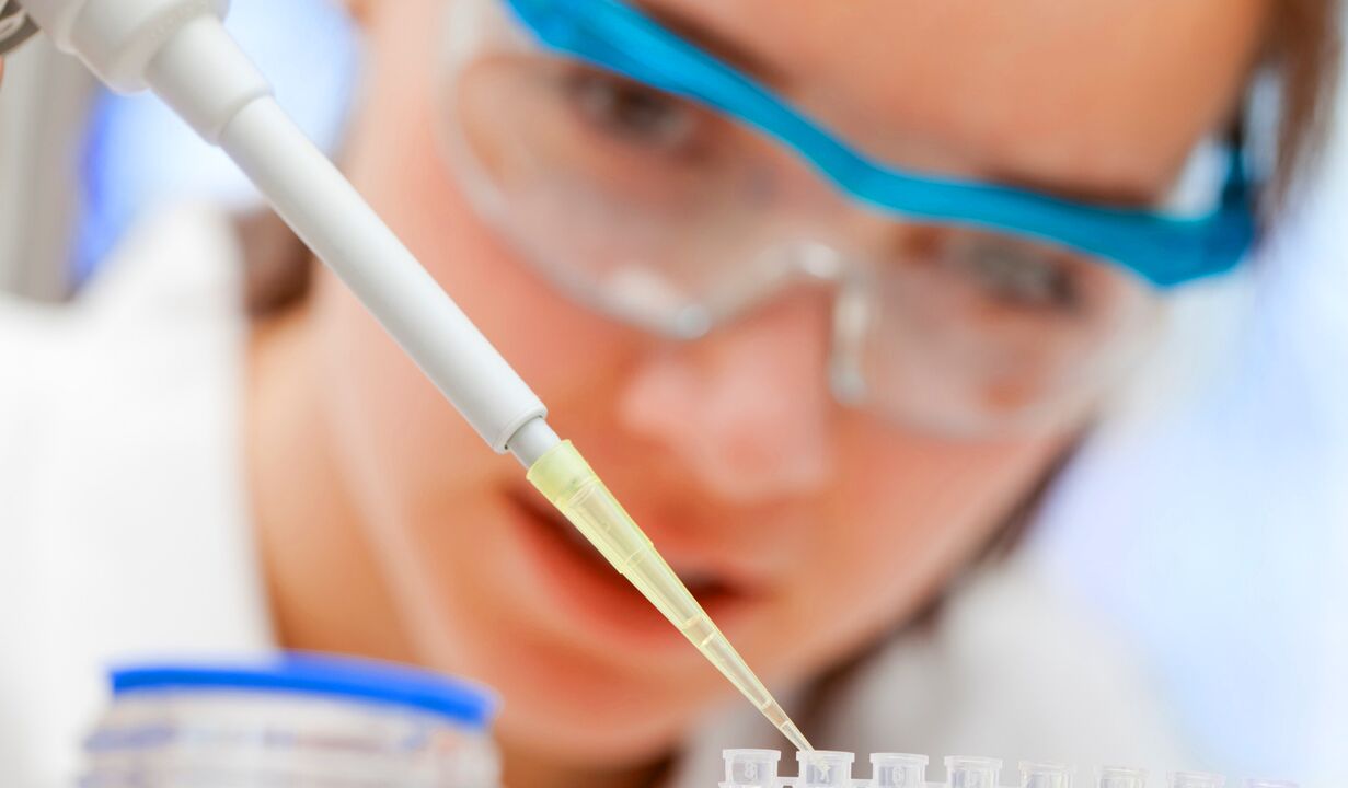 Laboranalyse des Urins eine Methode zur Diagnose von Prostatitis.