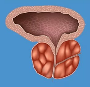 Typische Symptome der prostatitis