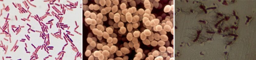 E. coli, fäkale Enterokokken und Proteus sind die Hauptverursacher der chronischen bakteriellen Prostatitis