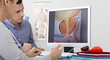 Prostatitis bei einem Mann diagnostizieren