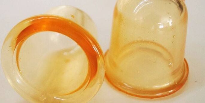 Banken zur Behandlung von Prostatitis