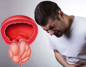 Die Symptome von chronischer prostatitis bei Männern